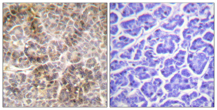 Ezrin + Radixin + Moesin Antibody - Immunohistochemistry analysis of paraffin-embedded human pancreas, using Moesin/Ezrin/Radixin (Phospho-Thr558) Antibody. The picture on the right is blocked with the phospho peptide.