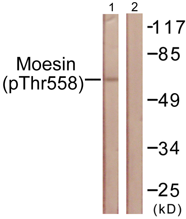 Ezrin + Radixin + Moesin Antibody - Western blot analysis of lysates from NIH/3T3 cells, using Moesin/Ezrin/Radixin (Phospho-Thr558) Antibody. The lane on the right is blocked with the phospho peptide.