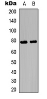 Ezrin + Radixin + Moesin Antibody - Western blot analysis of Ezrin/Radixin/Moesin (pT567/564/558) expression in SKOV3 (A); NIH3T3 (B) whole cell lysates.