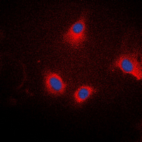 Ezrin + Radixin + Moesin Antibody - Immunofluorescent analysis of Ezrin/Radixin/Moesin (pT567/564/558) staining in SKOV3 cells. Formalin-fixed cells were permeabilized with 0.1% Triton X-100 in TBS for 5-10 minutes and blocked with 3% BSA-PBS for 30 minutes at room temperature. Cells were probed with the primary antibody in 3% BSA-PBS and incubated overnight at 4 deg C in a humidified chamber. Cells were washed with PBST and incubated with a DyLight 594-conjugated secondary antibody (red) in PBS at room temperature in the dark. DAPI was used to stain the cell nuclei (blue).