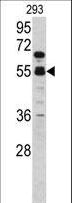 F10 / Factor X Antibody - Western blot of F10 antibody in 293 cell line lysates (35 ug/lane). F10 (arrow) was detected using the purified antibody.