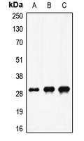 F10 / Factor X Antibody - Western blot analysis of Factor X HC expression in A549 colchicine-treated (A); mouse heart (B); rat heart (C) whole cell lysates.