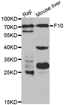 F10 / Factor X Antibody - Western blot analysis of extracts of various cell lines, using F10 antibody at 1:1000 dilution. The secondary antibody used was an HRP Goat Anti-Rabbit IgG (H+L) at 1:10000 dilution. Lysates were loaded 25ug per lane and 3% nonfat dry milk in TBST was used for blocking.