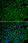 F10 / Factor X Antibody - Immunofluorescence analysis of A549 cells using F10 antibody. Blue: DAPI for nuclear staining.