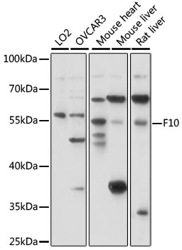 F10 / Factor X Antibody - Western blot analysis of extracts of various cell lines, using F10 antibody at 1:1000 dilution. The secondary antibody used was an HRP Goat Anti-Rabbit IgG (H+L) at 1:10000 dilution. Lysates were loaded 25ug per lane and 3% nonfat dry milk in TBST was used for blocking. An ECL Kit was used for detection and the exposure time was 10s.