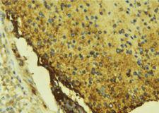 F10 / Factor X Antibody - 1:100 staining mouse liver tissue by IHC-P. The sample was formaldehyde fixed and a heat mediated antigen retrieval step in citrate buffer was performed. The sample was then blocked and incubated with the antibody for 1.5 hours at 22°C. An HRP conjugated goat anti-rabbit antibody was used as the secondary.