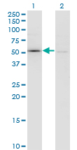 F11 / FXI / Factor XI Antibody - Western Blot analysis of F11 expression in transfected 293T cell line by F11 monoclonal antibody (M01), clone 2H8.Lane 1: F11 transfected lysate(70.1 KDa).Lane 2: Non-transfected lysate.
