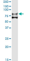 F11 / FXI / Factor XI Antibody - Immunoprecipitation of F11 transfected lysate using anti-F11 monoclonal antibody and Protein A Magnetic Bead, and immunoblotted with F11 rabbit polyclonal antibody.