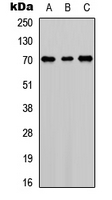 F11 / FXI / Factor XI Antibody - Western blot analysis of Factor XI LC expression in HEK293T (A); NS-1 (B); PC12 (C) whole cell lysates.