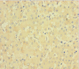 F11 / FXI / Factor XI Antibody - Immunohistochemistry of paraffin-embedded human liver tissue using F11 Antibody at dilution of 1:100