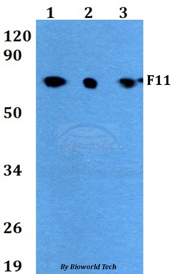 F11 / FXI / Factor XI Antibody - Western blot of F11 antibody at 1:500 dilution. Lane 1: HEK293T whole cell lysate. Lane 2: sp2/0 whole cell lysate. Lane 3: PC12 whole cell lysate.