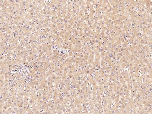 F11 / FXI / Factor XI Antibody - Immunochemical staining of human FA11 in human liver with rabbit polyclonal antibody at 1:300 dilution, formalin-fixed paraffin embedded sections.