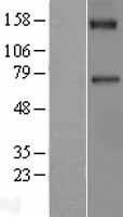 F11 / FXI / Factor XI Protein - Western validation with an anti-DDK antibody * L: Control HEK293 lysate R: Over-expression lysate