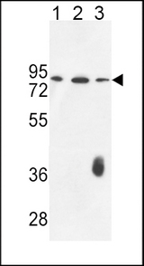 F12 / Factor XII Antibody - F12 Antibody western blot of K562(lane 1),CEM(lane 2),MDA-MB435(lane 3) cell line lysates (35 ug/lane). The F12 antibody detected the F12 protein (arrow).