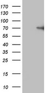 F12 / Factor XII Antibody - HEK293T cells were transfected with the pCMV6-ENTRY control. (Left lane) or pCMV6-ENTRY F12. (Right lane) cDNA for 48 hrs and lysed. Equivalent amounts of cell lysates. (5 ug per lane) were separated by SDS-PAGE and immunoblotted with anti-F12. (1:2000)