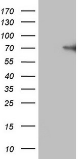 F12 / Factor XII Antibody - HEK293T cells were transfected with the pCMV6-ENTRY control. (Left lane) or pCMV6-ENTRY F12. (Right lane) cDNA for 48 hrs and lysed. Equivalent amounts of cell lysates. (5 ug per lane) were separated by SDS-PAGE and immunoblotted with anti-F12. (1:2000)