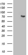 F12 / Factor XII Antibody - HEK293T cells were transfected with the pCMV6-ENTRY control. (Left lane) or pCMV6-ENTRY F12. (Right lane) cDNA for 48 hrs and lysed. Equivalent amounts of cell lysates. (5 ug per lane) were separated by SDS-PAGE and immunoblotted with anti-F12. (1:500)