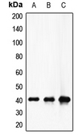 F12 / Factor XII Antibody - Western blot analysis of Factor XII HC expression in HeLa (A); mouse lung (B); rat heart (C) whole cell lysates.