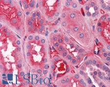 F12 / Factor XII Antibody - Kidney: Formalin-Fixed, Paraffin-Embedded (FFPE)