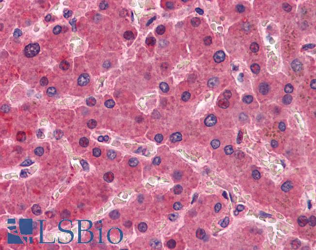 F12 / Factor XII Antibody - Anti-F12 / Factor XII antibody IHC of human liver. Immunohistochemistry of formalin-fixed, paraffin-embedded tissue after heat-induced antigen retrieval. Antibody concentration 5 ug/ml.