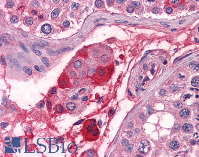 F12 / Factor XII Antibody - Testis: Formalin-Fixed, Paraffin-Embedded (FFPE)