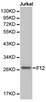F12 / Factor XII Antibody - Western blot of extracts of Jurkat cell lines, using F12 antibody.