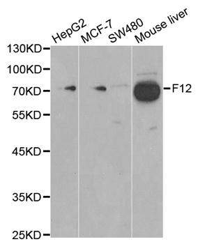 F12 / Factor XII Antibody - Western blot analysis of extracts of various cell lines, using F12 antibody at 1:1000 dilution. The secondary antibody used was an HRP Goat Anti-Rabbit IgG (H+L) at 1:10000 dilution. Lysates were loaded 25ug per lane and 3% nonfat dry milk in TBST was used for blocking.