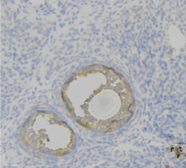F12 / Factor XII Antibody - 1:100 staining human uterus tissue by IHC-P. The sample was formaldehyde fixed and a heat mediated antigen retrieval step in citrate buffer was performed. The sample was then blocked and incubated with the antibody for 1.5 hours at 22°C. An HRP conjugated goat anti-rabbit antibody was used as the secondary.