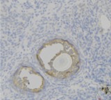 F12 / Factor XII Antibody - 1:100 staining human uterus tissue by IHC-P. The sample was formaldehyde fixed and a heat mediated antigen retrieval step in citrate buffer was performed. The sample was then blocked and incubated with the antibody for 1.5 hours at 22°C. An HRP conjugated goat anti-rabbit antibody was used as the secondary.