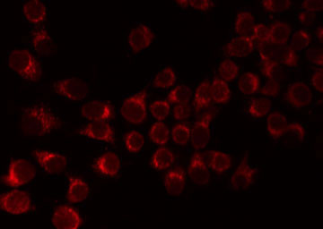 F12 / Factor XII Antibody - Staining 293 cells by IF/ICC. The samples were fixed with PFA and permeabilized in 0.1% Triton X-100, then blocked in 10% serum for 45 min at 25°C. The primary antibody was diluted at 1:200 and incubated with the sample for 1 hour at 37°C. An Alexa Fluor 594 conjugated goat anti-rabbit IgG (H+L) Ab, diluted at 1/600, was used as the secondary antibody.