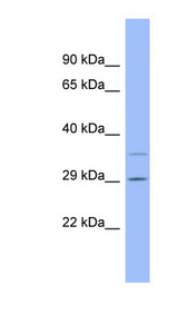 F12 / Factor XII Antibody - F12 / Factor XII antibody Western blot of Fetal Thymus lysate. This image was taken for the unconjugated form of this product. Other forms have not been tested.