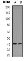F12 / Factor XII Antibody - Western blot analysis of Factor XII HC expression in MDAMB435 (A); NIH3T3 (B) whole cell lysates.