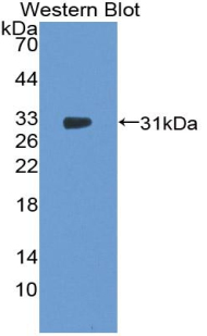 F13A1 / Factor XIIIa Antibody - Western blot of recombinant F13A1 / Factor XIIIa.