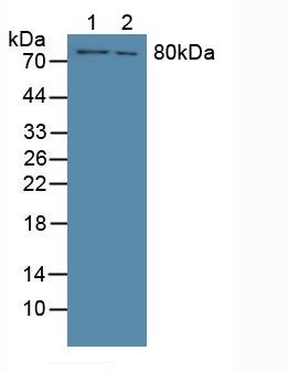 F13A1 / Factor XIIIa Antibody - Western Blot; Sample: Lane1: Human Lung Tissue; Lane2: Human A549 Cells.