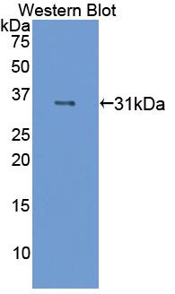 F13A1 / Factor XIIIa Antibody - Western blot of F13A1 / Factor XIIIa antibody.