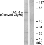 F13A1 / Factor XIIIa Antibody - Western blot of extracts from Jurkat cells, treated with etoposide 25 uM 24h, using FA13A (Cleaved-Gly39) Antibody. The lane on the right is treated with the synthesized peptide.