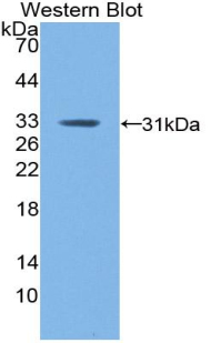 F13A1 / Factor XIIIa Antibody - Western blot of recombinant F13A1 / Factor XIIIa.
