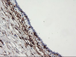 F13A1 / Factor XIIIa Antibody - IHC of paraffin-embedded Human breast tissue using anti-F13A1 mouse monoclonal antibody.