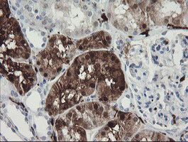 F13A1 / Factor XIIIa Antibody - IHC of paraffin-embedded Human Kidney tissue using anti-F13A1 mouse monoclonal antibody.