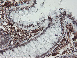 F13A1 / Factor XIIIa Antibody - IHC of paraffin-embedded Human colon tissue using anti-F13A1 mouse monoclonal antibody.