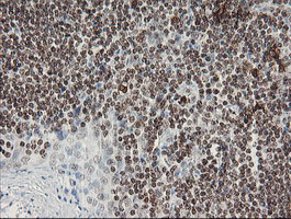 F13A1 / Factor XIIIa Antibody - IHC of paraffin-embedded Human tonsil using anti-F13A1 mouse monoclonal antibody.