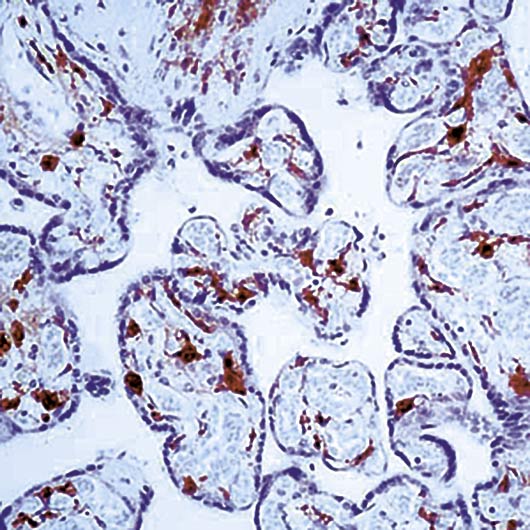 F13A1 / Factor XIIIa Antibody - Formalin-fixed, paraffin-embedded human placenta stained with Factor XIIIA antibody.