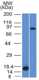F13A1 / Factor XIIIa Antibody - Western blot testing of 1) partial human recombinant protein and 2) human HeLa lysate with Factor XIIIa antibody (clone F13A1/1448). Expected molecular weight ~83 kDa.