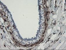 F13A1 / Factor XIIIa Antibody - IHC of paraffin-embedded Human breast tissue using anti-F13A1 mouse monoclonal antibody.