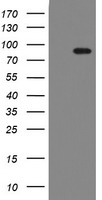 F13A1 / Factor XIIIa Antibody - HEK293T cells were transfected with the pCMV6-ENTRY control (Left lane) or pCMV6-ENTRY F13A1 (Right lane) cDNA for 48 hrs and lysed. Equivalent amounts of cell lysates (5 ug per lane) were separated by SDS-PAGE and immunoblotted with anti-F13A1.