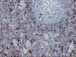 F13A1 / Factor XIIIa Antibody - IHC of paraffin-embedded Human tonsil using anti-F13A1 mouse monoclonal antibody.
