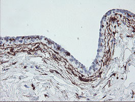 F13A1 / Factor XIIIa Antibody - IHC of paraffin-embedded Human breast tissue using anti-F13A1 mouse monoclonal antibody.