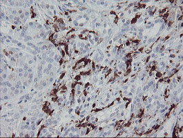 F13A1 / Factor XIIIa Antibody - IHC of paraffin-embedded Human pancreas tissue using anti-F13A1 mouse monoclonal antibody.