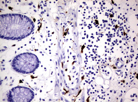 F13A1 / Factor XIIIa Antibody - IHC of paraffin-embedded Human colon tissue using anti-F13A1 mouse monoclonal antibody. (Heat-induced epitope retrieval by 10mM citric buffer, pH6.0, 120°C for 3min).