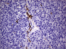 F13A1 / Factor XIIIa Antibody - IHC of paraffin-embedded Human pancreas tissue using anti-F13A1 mouse monoclonal antibody. (Heat-induced epitope retrieval by 10mM citric buffer, pH6.0, 120°C for 3min).